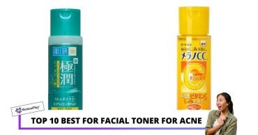 Top Best For Facial Toner for Acne