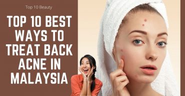 Top Best Ways To Treat Back Acne in Malaysia