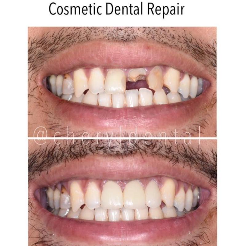 10 Klinik Pergigian Terbaik di Sabah 2025 7 Cheryl-Dental-Surgery-