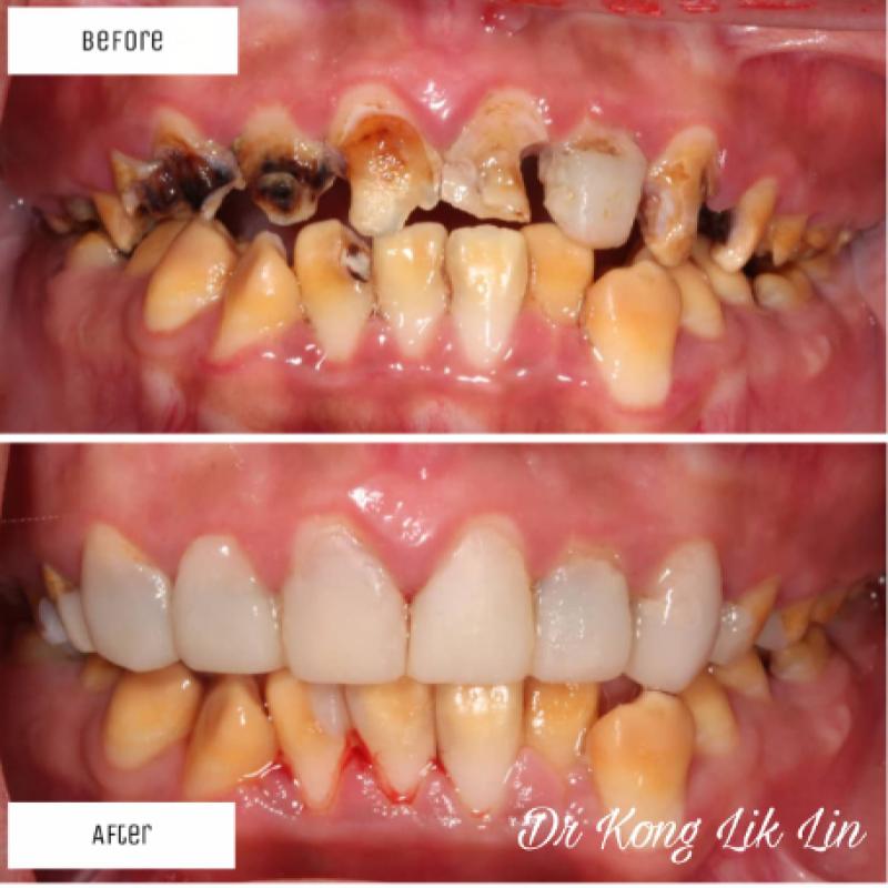 Top 10 Best Dental Clinics in Sarawak 2025 15 Yong-Dental-Surgery-