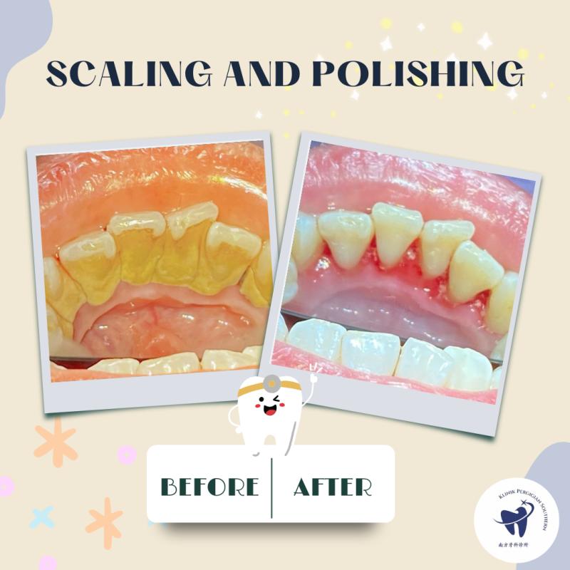 Top 10 Best Dental Clinics in Johor Bahru 2026 21 Klinik Pergigian Southern 1