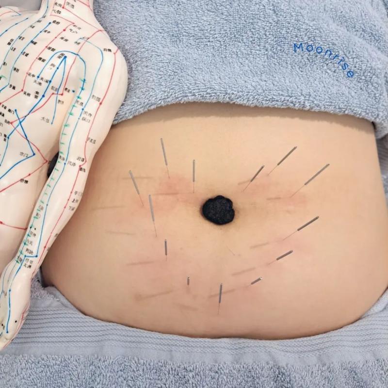 Top 10 Best Traditional Chinese Medicine Stores Near PJ & KL 2025 21 Moonrise-Acupuncture-Medical-Center-