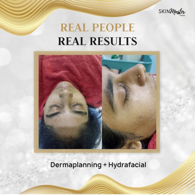 20 Rawatan Facial Terbaik Di Kuala Lumpur 2025 14 Skin-Master-