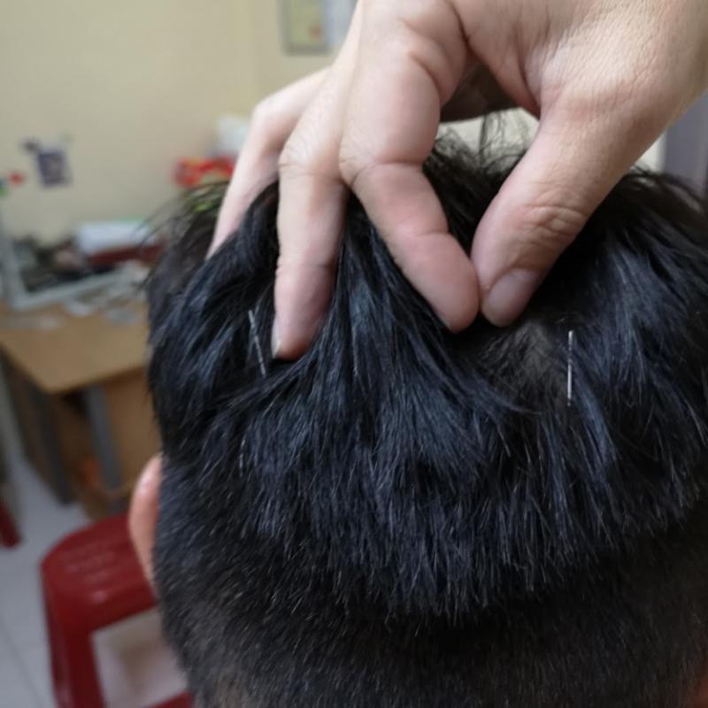 Top 10 Best Acupuncture Services in Melaka 2025 11 BL-TCM-Centre-