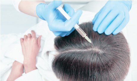 Top 10 Best Hair Loss Treatment Centers in Penang 2025 7 Clinic-RX-