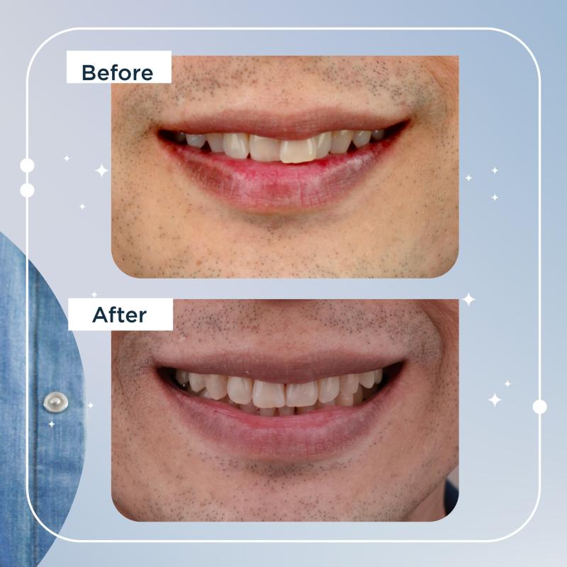 <strong>10 Klinik Invisalign Terbaik di Malaysia 2025</strong> 21 Dentists-Co-Dental-Clinic-