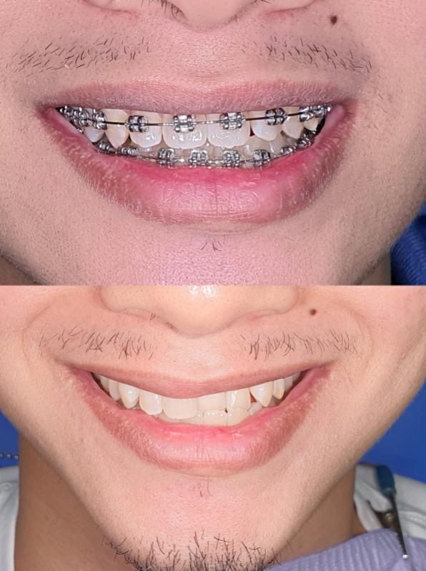 Top 10 Best Dental Clinics in Melaka 2025 19 Great-Smile-Dental-