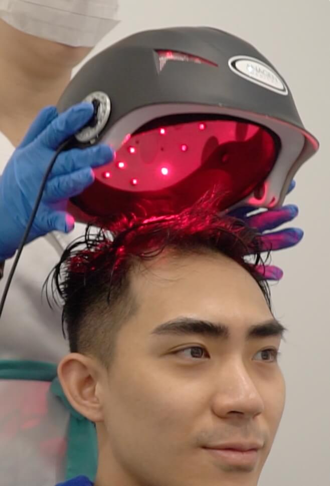 Top 10 Best Hair Loss Treatment Centers in Penang 2025 9 Hair-Doc-Bukit-Mertajam-