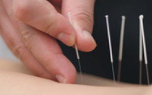 Top 10 Best Acupuncture Services in Penang 2025 3 Happy-Life-Wellness-Therapy-Centre-