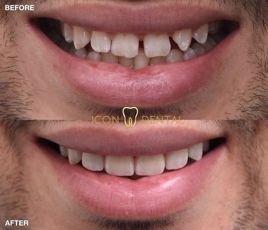 <strong>10 Klinik Veneer Terbaik di Malaysia 2025</strong> 7 Icon-Dental-Kepong--