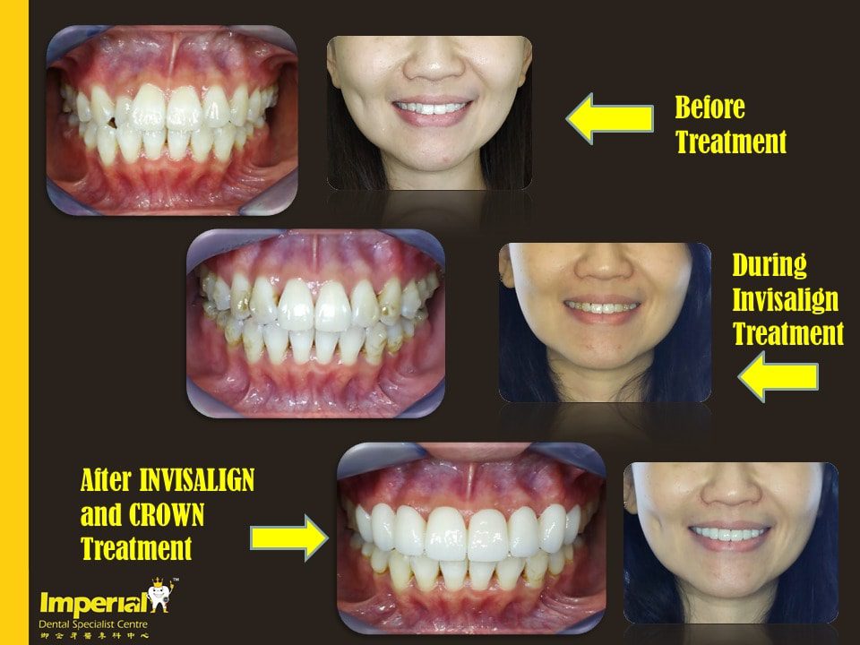 Top 10 Best Invisalign Clinics in Malaysia 2025 3 Imperial-Dental-Specialist-Centre--