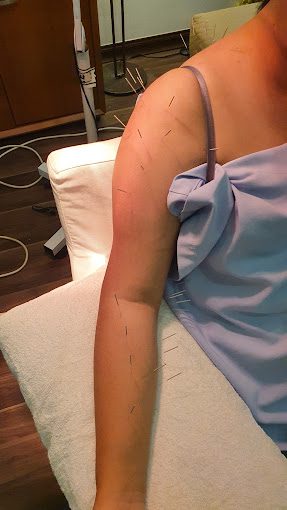 10 Perkhidmatan Akupunktur Terbaik di KL & Selangor 2025 9 Jungs-Oriental-Medical-Clinic-