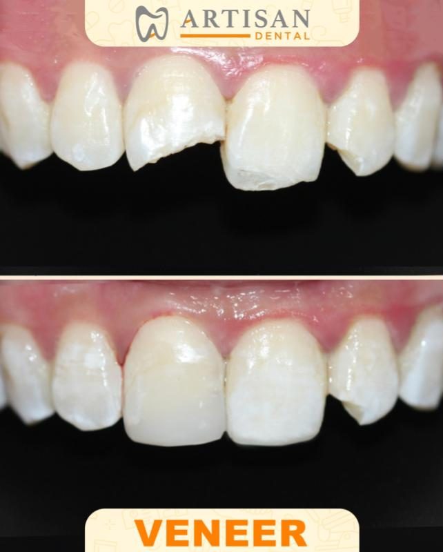 Top 10 Best Dental Clinics in Kedah 2025 7 Klinik-Pergigian-Artisan-@-Padang-Serai-