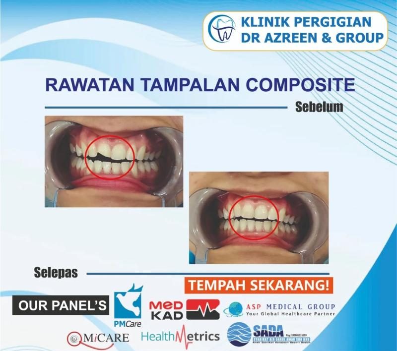 Top 10 Best Dental Clinics in Kedah 2025 17 Klinik-Pergigian-Dr-Azreen-