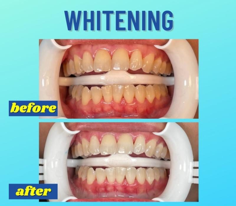 Top 10 Best Dental Clinics in Melaka 2025 3 Klinik-Pergigian-Impian-