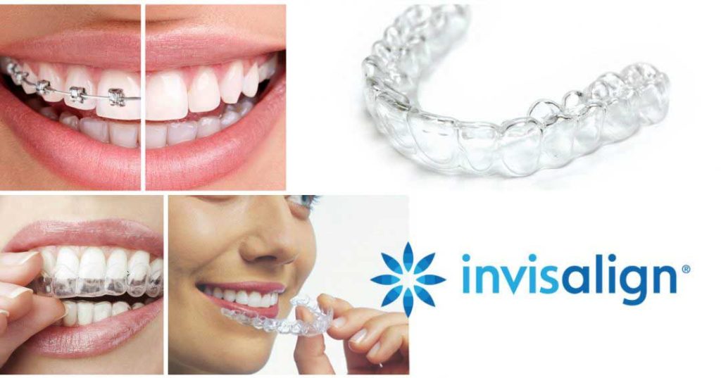 Top 10 Best Invisalign Clinics in Malaysia 2025 10 Lau-Dental-Clinic-Surgery-Sri-Petaling--