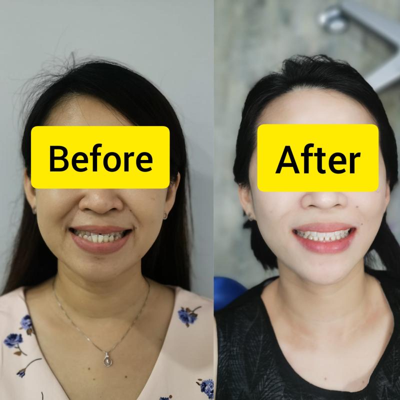 Top 10 Best Invisalign Clinics in Malaysia 2025 12 LeSmile-Dental-Clinic-Sri-Petaling-KL-