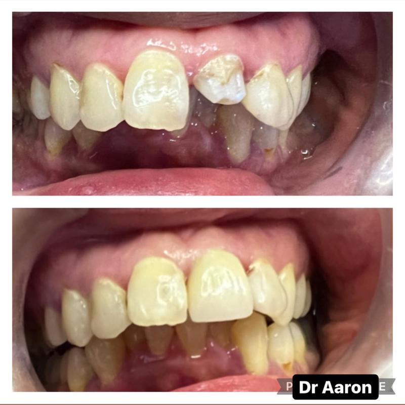 <strong>10 Klinik Veneer Terbaik di Malaysia 2025</strong> 9 Lumiere-Dental-Clinic-Puncak-Jalil-