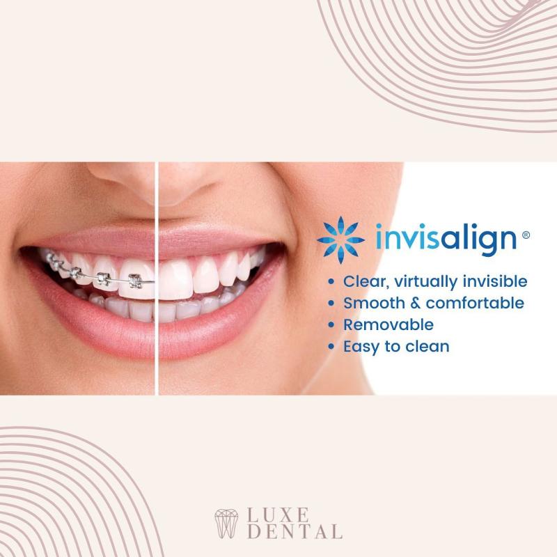 Top 10 Best Invisalign Clinics in Malaysia 2025 20 Luxe-Dental-Clinic-PJ-