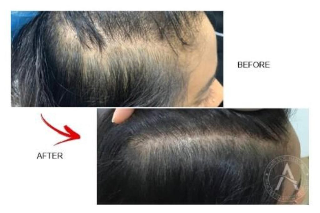 <strong>8 Pusat Rawatan Rambut Gugur Terbaik di Melaka 2025</strong> 12 One-Doc-Melaka-