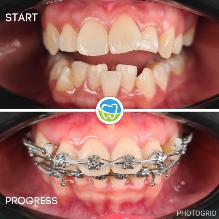 Top 10 Best Dental Clinics in Melaka 2025 15 Ooi-Dental-