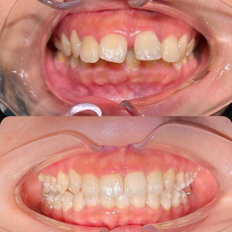 Top 10 Best Invisalign Clinics in Malaysia 2025 5 ParkHill-Dental-Clinic-SS-