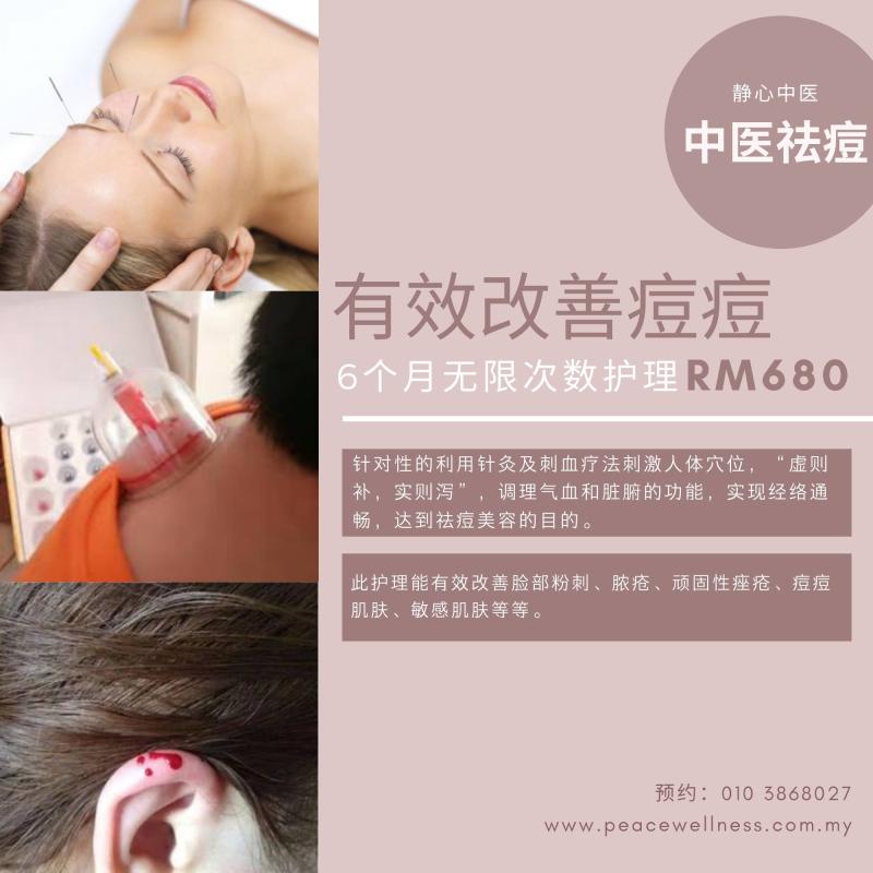 Top 10 Best Acupuncture Services in Johor 2025 18 Peace-Wellness-TCM-Acupuncture-