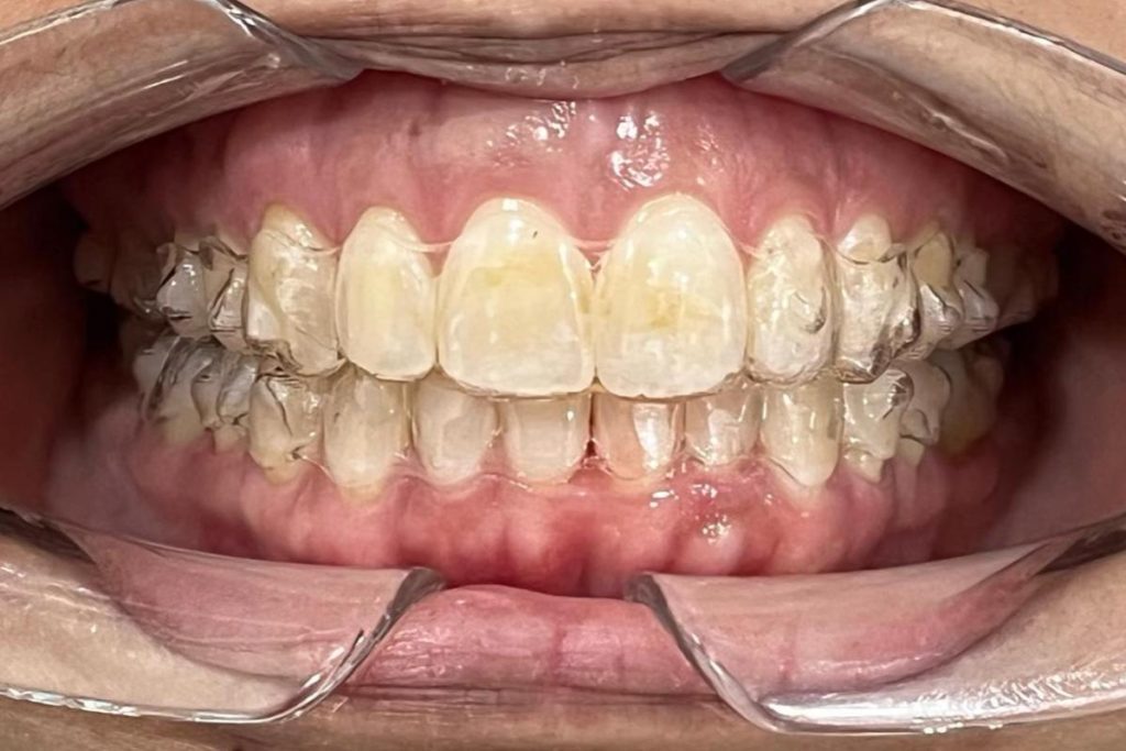 Top 10 Best Invisalign Clinics in Malaysia 2025 18 Regalis-Dental-Surgery--