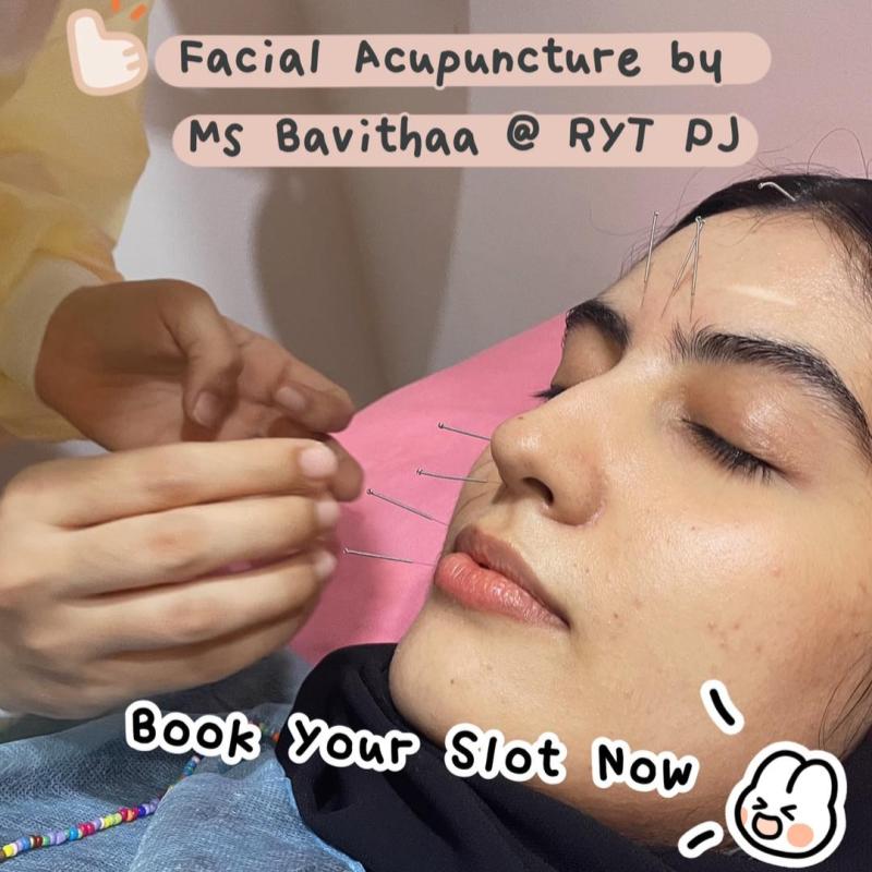 10 Perkhidmatan Akupunktur Terbaik di KL & Selangor 2025 13 Ren-Yi-Tang-Acupuncture-Traditional-Chinese-Medicine-Center-