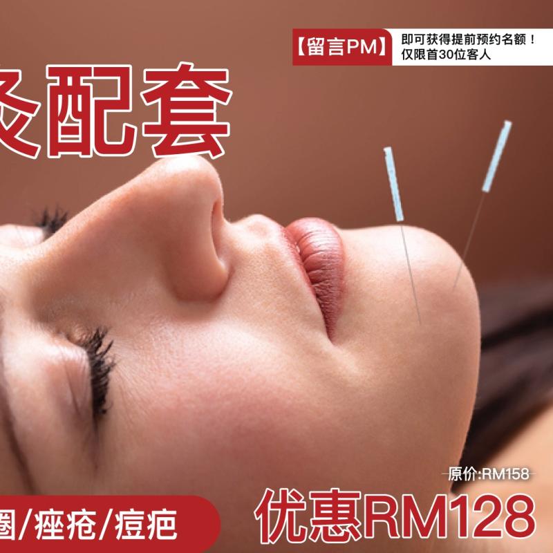 Top 10 Best Acupuncture Services in Ipoh 2025 5 Ruyi-TCM-Center-