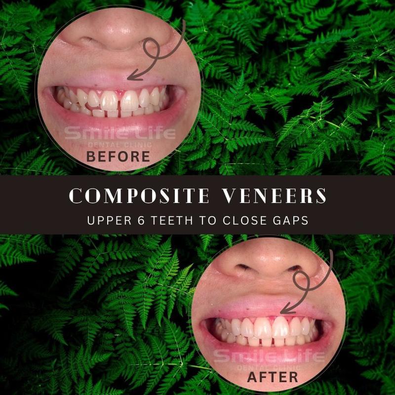 <strong>10 Klinik Veneer Terbaik di Malaysia 2025</strong> 3 Smile-Life-Dental-Clinic--