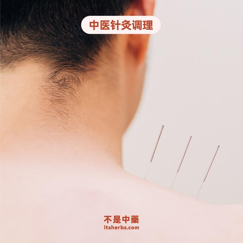 10 Perkhidmatan Akupunktur Terbaik di KL & Selangor 2025 5 itsherbs.com-@-Puchong-