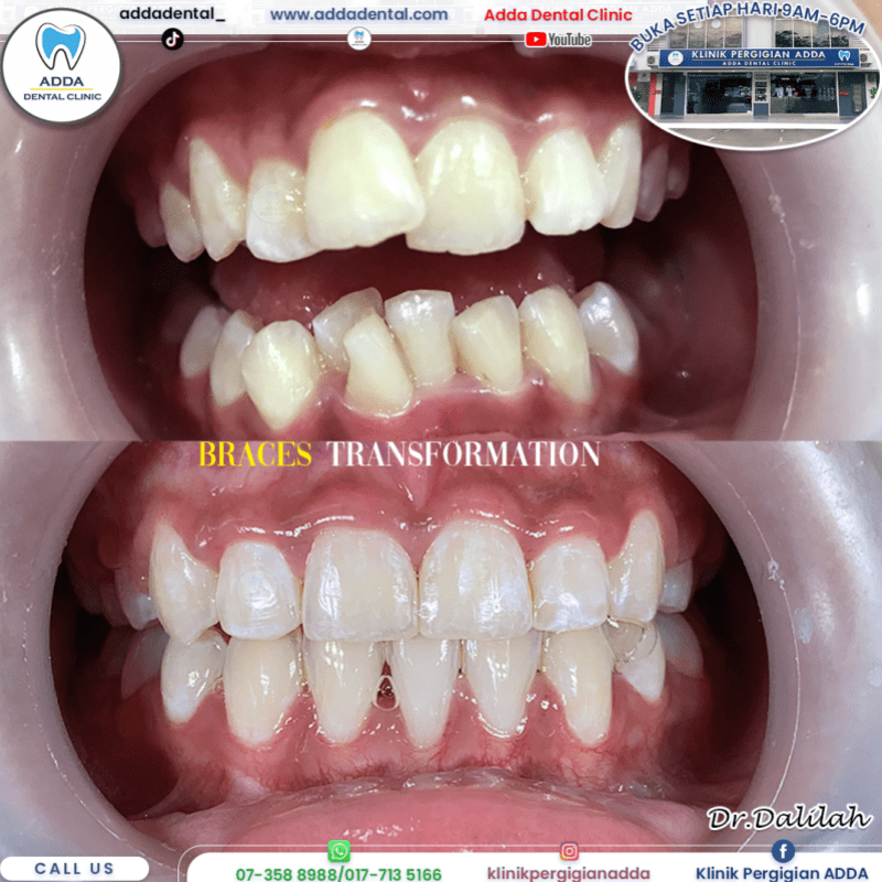 10 Klinik Pergigian Terbaik di Johor Bahru 2026 3 adda