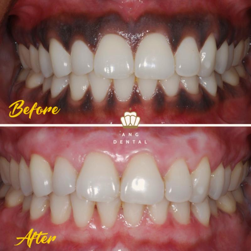 10 Klinik Pergigian Terbaik di Johor Bahru 2026 15 ang