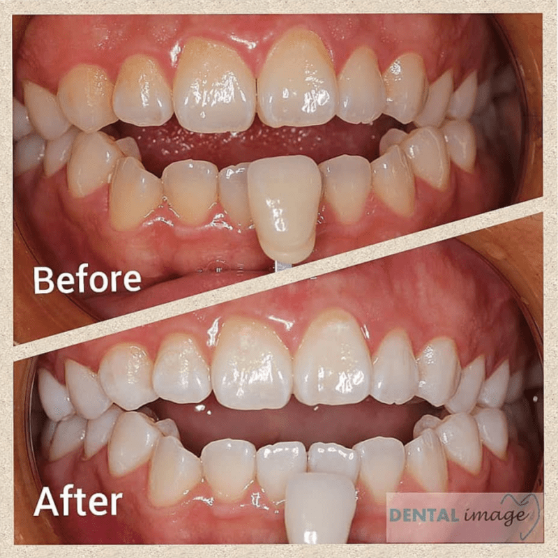 20 Klinik Pergigian Terbaik di KL & Selangor 2025 36 dental-image