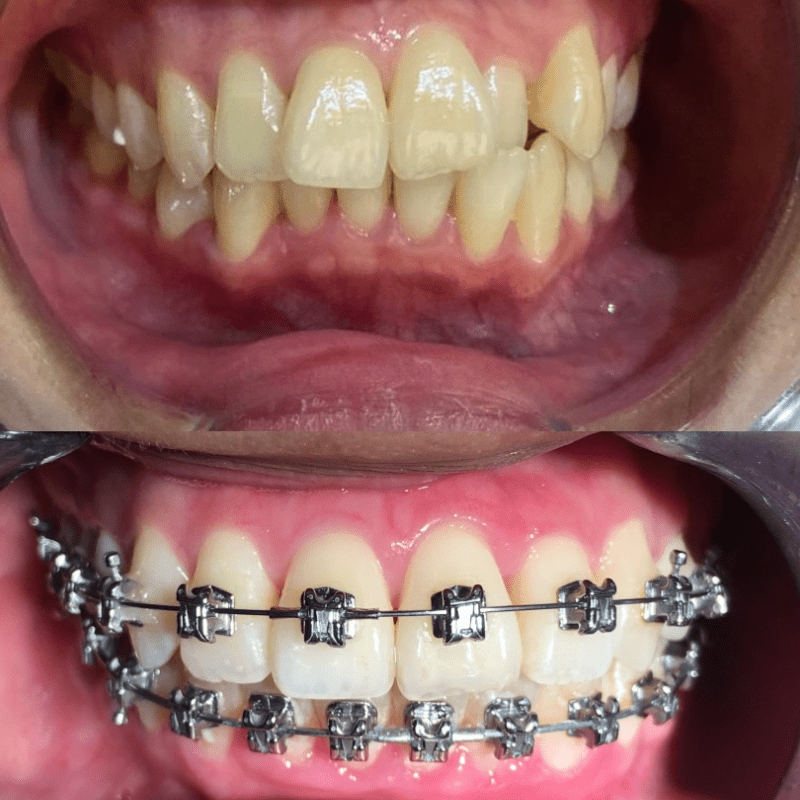 Top 15 Best Dental Clinics in Ipoh 2025 22 dentits-