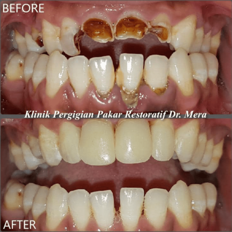 Top 15 Best Dental Clinics in Ipoh 2025 18 dr-mera