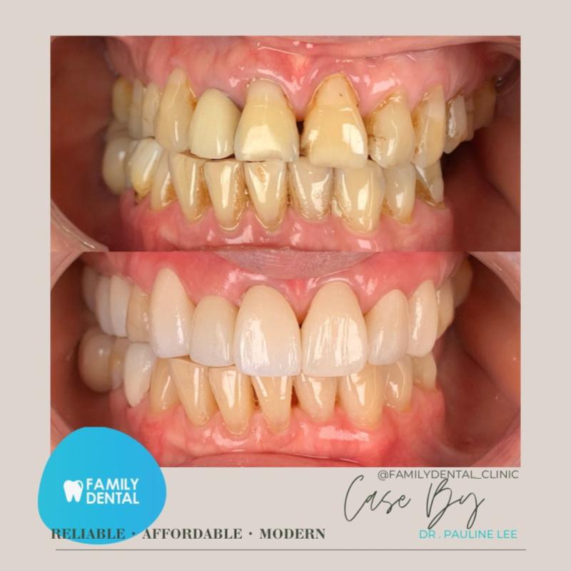 Top 10 Best Dental Clinics in Penang 2025 20 family-dental