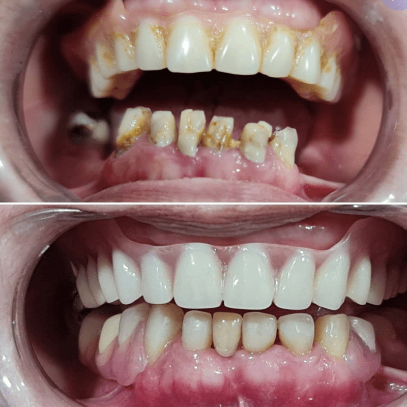 Top 10 Best Dental Clinics in Penang 2025 16 hygge-