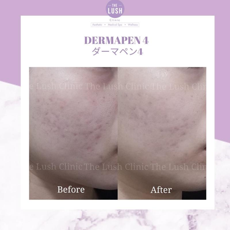 Top 20 Best Aesthetic Clinics in KL & Selangor 2025 17 lush-