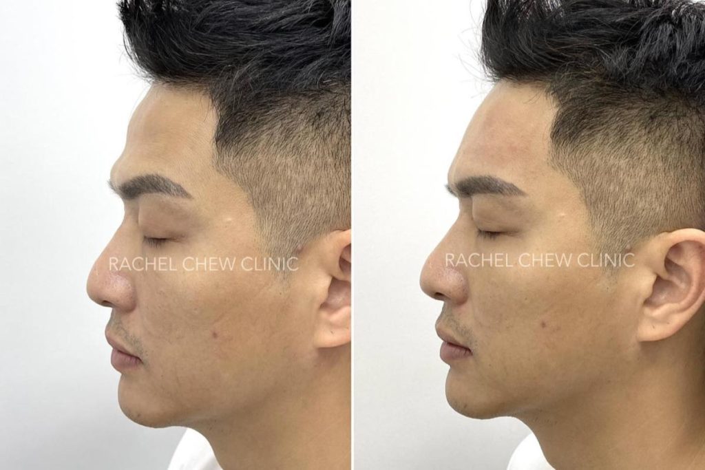 Top 20 Best Aesthetic Clinics in KL & Selangor 2025 40 rachel-