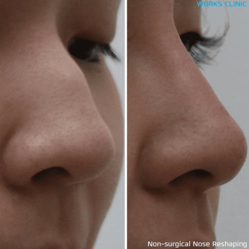 Top 18 Best Aesthetic Clinics in Penang 2025 16 skin-works