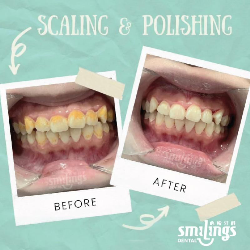 10 Klinik Pergigian Terbaik di Johor Bahru 2026 21 smilings