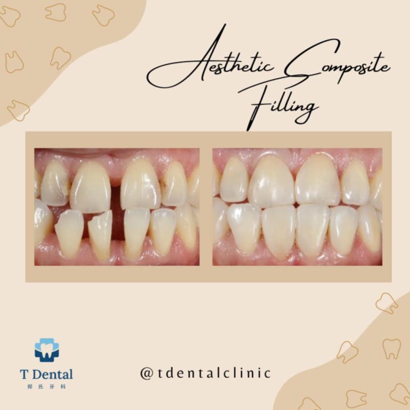 10 Klinik Pergigian Terbaik di Johor Bahru 2026 9 tdental