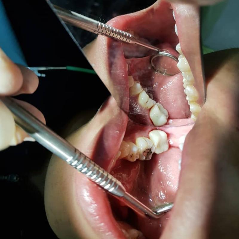 Top 15 Best Dental Clinics in Ipoh 2025 3 waysmile-