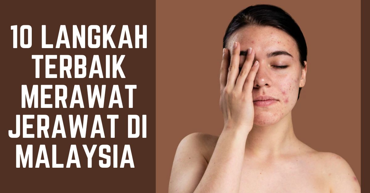 Langkah Terbaik Merawat Jerawat di Malaysia