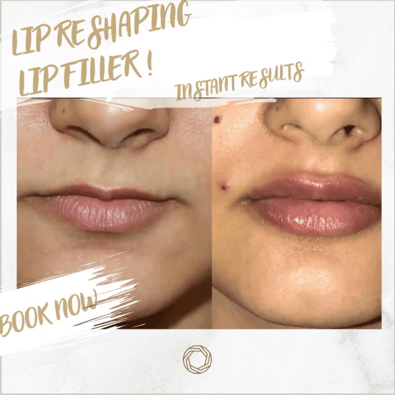 20 Klinik Estetik Terbaik di KL & Selangor 2025 8 CLEO Clinic Aesthetic Skin Center 1