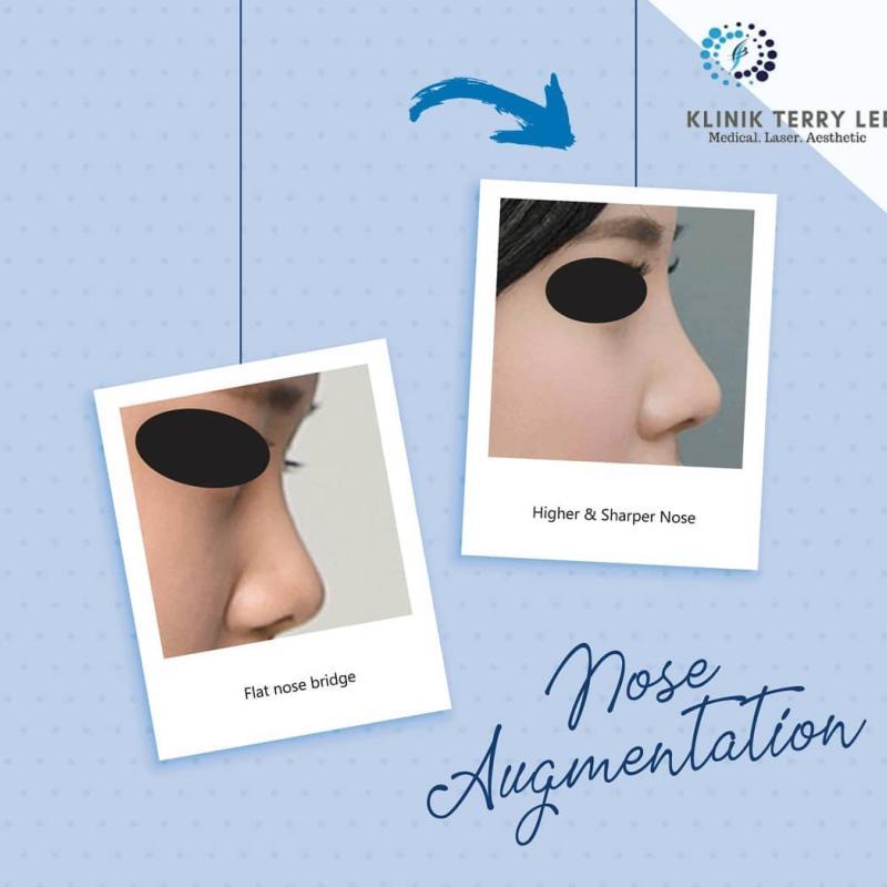 20 Klinik Estetik Terbaik di KL & Selangor 2025 35 Klinik Terry Lee 1