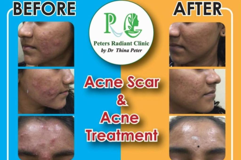 20 Klinik Estetik Terbaik di KL & Selangor 2025 27 Peters Radiant Clinic 1