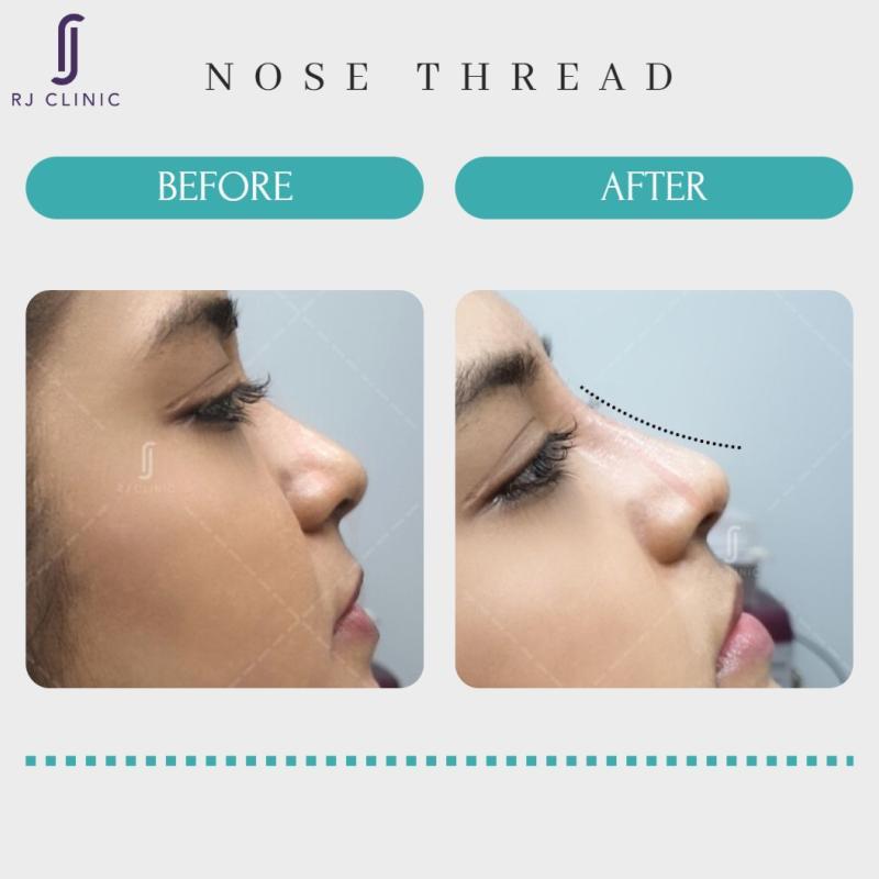 20 Klinik Estetik Terbaik di KL & Selangor 2025 18 RJ Clinic @ Ativo Plaza 1